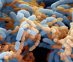 Lactobacillus paracasei